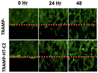 Hexim1 haploinsufficiency enhances the expression of epithelial–mesenchymal migration markers in wound-healing assay.