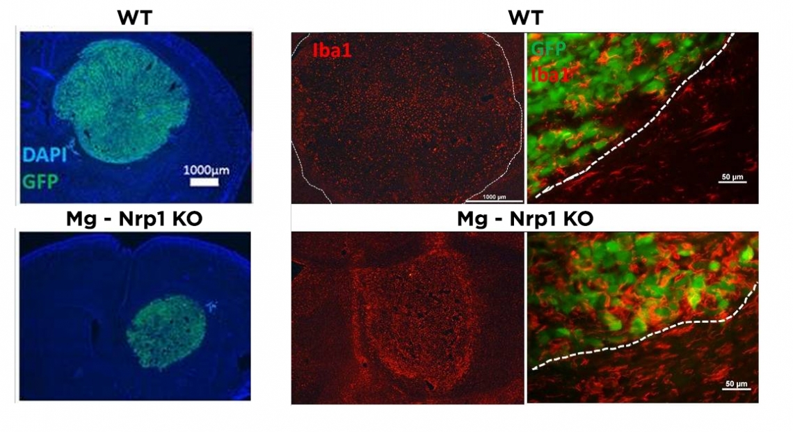 Inflammatory microglia function in a tumoricidal manner